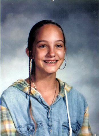 jamie-braces